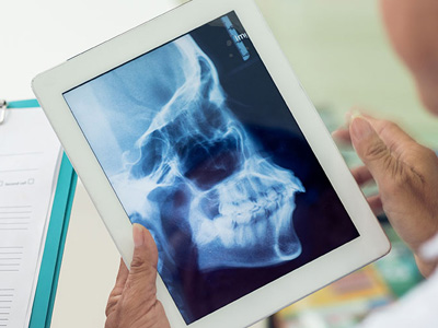 A person holding a tablet displaying an X-ray image, with a clipboard and a paper form nearby.