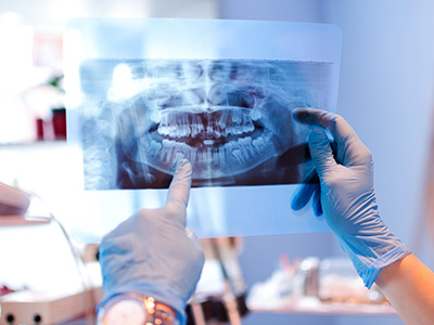 A dental professional examines an X-ray of a patient s teeth and mouth using a magnifying glass.