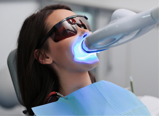 In-Office Teeth Whitening