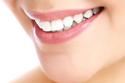 An image of a woman with a radiant smile showcasing her teeth, likely for dental care or cosmetic purposes.