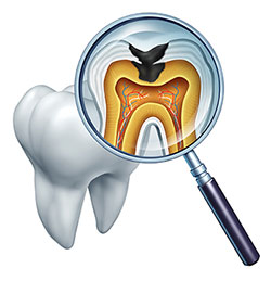 The image shows a magnified view of a tooth with an open crown through which a detailed internal dental structure is visible, including the pulp chamber, root canals, and the surrounding bone tissue, all viewed under a microscope with a focus on the cavity area.