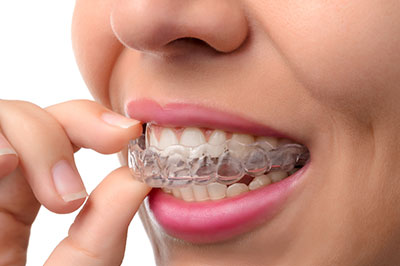 An adult woman with braces, holding a toothpaste tube and looking at her teeth.