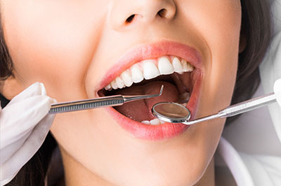 The image shows a woman with an open mouth being attended to by dental professionals, who are using instruments to examine her teeth.