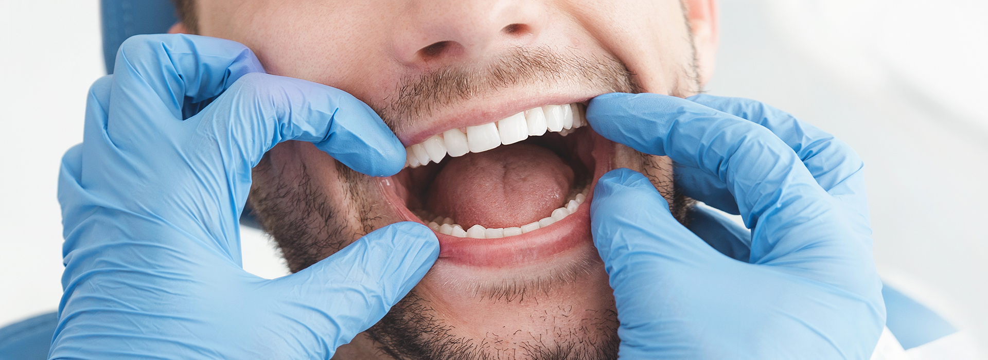 The image shows a person with an open mouth wearing dental gloves, suggesting they are either a dentist or involved in dental care.