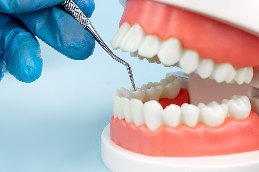 Dental Implants vs. Dentures: Understanding Your Options